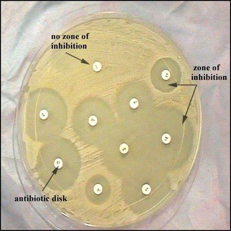 Antimicrobial Sensitivity Testing Kirby Bauer Method