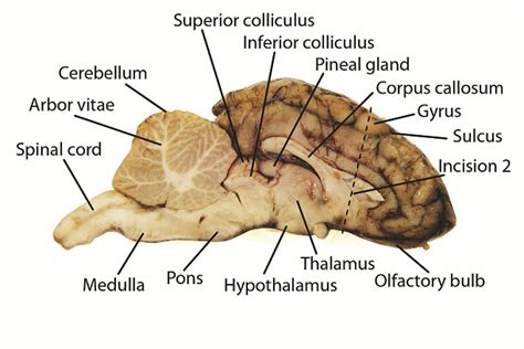 Cross Section Of A Sheep Brain