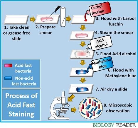 During The Acid Fast Stain Steam Is Used To