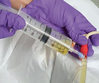 How To Obtain Urine Sample From Foley Catheter