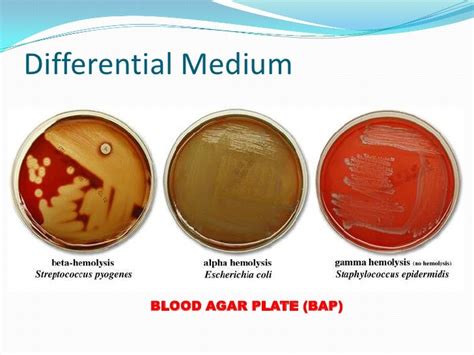 Is Blood Agar Selective Or Differential