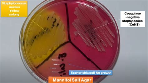 Is Mannitol Salt Agar Selective Or Differential