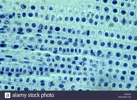 Mitosis Of An Onion Root Tip