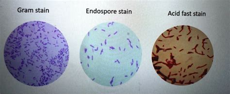 The Gram Stain Acid-fast Stain And Endospore Stain