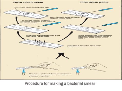 What Is Involved In Making A Smear